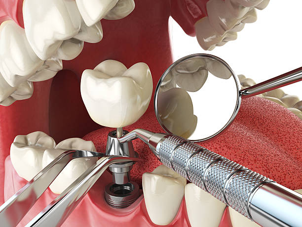 Best Emergency Tooth Extraction  in Soh Jordan, UT